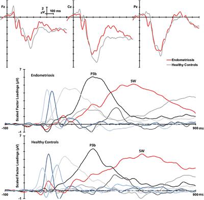 Neuronal Correlates of Cognitive Control Are Altered in Women With Endometriosis and Chronic Pelvic Pain